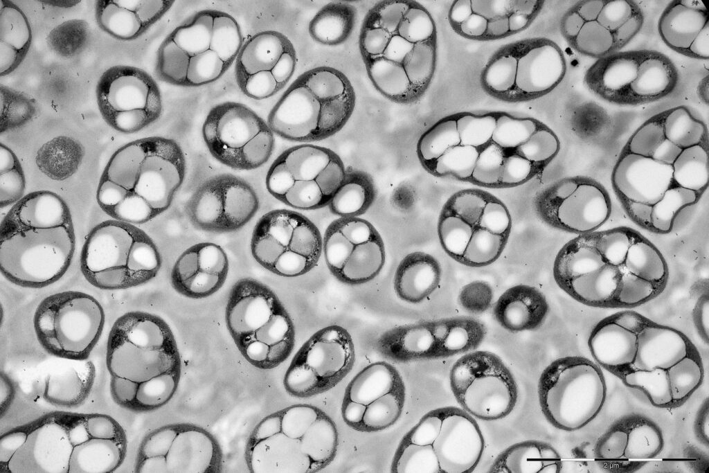 Bacterias productoras de PHA 15 Bacterias productoras de PHA 15 - Clave Web